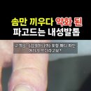 솜만 끼우다 악화된 파고드는 내성발톱 고객님 ㅠㅠ 깨끗하게 관리해드렸어요😧 #패디파인 이미지