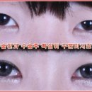 오투성형외과 이미지