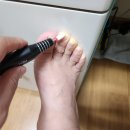 전동네일드릴 큐티클 무좀발톱 제거 힐메딕 사용 후기