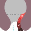 [기록] 춘천 하나의원 화천 양구 항문외과 치질 항문 수술 병원 홍천 철원 인제 항외과 다녀온 후기