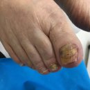 푸스케어 남포점 글림네일 이미지