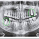 이수치과기공소 이미지