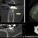 확실한강치과의원 | 목포 임플란트 잘하는 치과 - 확실한강치과의원.