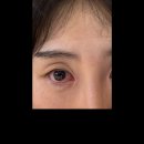 잘보는성모안과의원 이미지