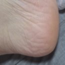 큐브 케어 | 발냄새·각질 케어 시작! 사용 후기 [큐브 무조미 업그레이드 발비누]