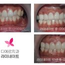 만나치과기공소 이미지