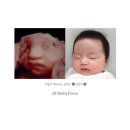 인화약국 | #임신일기 33주 | 베이비페이스 후기 내돈내산 다이소템으로 꾸미기(ft.손 화상) &amp; 추천코드