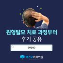 맥스모외과의원 | 화곡동 원형탈모 치료 과정부터 후기 공유 (사진有)