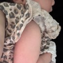 구리시 행정복지센터 | 구리 BCG접종 피내용 수택보건지소 방문후기 │ 피내용 흉터 접종 경과