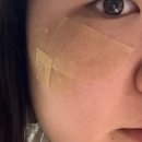 윤블리 네일샵 | 인천 부평 멜라즈마·기미·흑자 케어 후기 | 윤블리네일에서 잡티지우개 시술 받고 왔어요