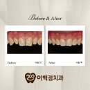 퍼스널치과기공소 이미지