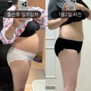 지로한의원 | [다이어트] 둘째 출산맘의 요요없는 산후다이어트, 82kg👉62kg “3개월간 20kg감량 성공” 내돈내산...