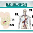 "나는 몸신이다" 유방암에 관한 모든 것 이미지