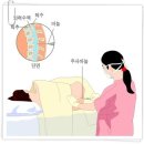 뇌수막염 이미지