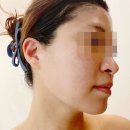 주주 스킨앤바디 | 수지피부관리 추천 수지구청역 1분 주주스킨앤바디 모찌윤곽관리 등순환관리 솔직후기