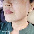 해초랑 | 쥴레 리뉴엑스 해초필링 얼굴후기
