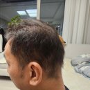 한미미용실 | 탈모 샴푸 추천 두피 각질 풍성한 거품 트리코닉스 후기