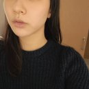 오늘안피부과에서 라페라리프팅받은 후기:)