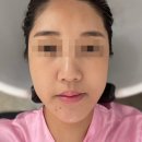 오리진뷰티온 | [제주-연동] 제주에스테틱 '오리진뷰티온' 목숨관리 후기