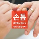 손톱세로줄/손톱검은세로줄/손톱갈라짐 (손톱영양제,발톱갈라짐 관리)
