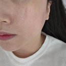 월명로 | [뷰티] 청주 봉명동 피부관리, 피아나 뷰티랩에서 수분절임관리 받은 후기