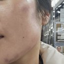 타운지 | 광주 첨단 윤곽관리 도하담 에스테틱 인모드·하이푸 리프팅 솔직후기