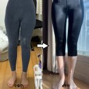허벅지지방흡입후기 4000cc 안쪽까지 뽑은 전후 한달차, 6주차 사진!(+사후관리)