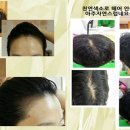 헤어디자인 아이리스