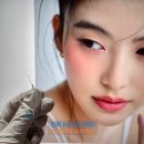 수아연한의원 | 코수술 흉살 코 흉살 후기가 증명하는 (콧등 콧대 콧볼 코끝 비주ㅣ호전사례 다수) 진짜 재생치료