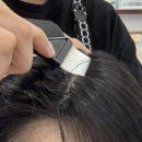 미채움두피 잠실석촌점