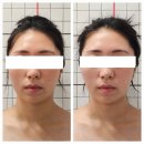 부산 체형교정 잘하는 비대칭 체형관리 약손금손