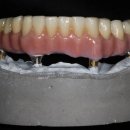 엘리트치과기공소 이미지