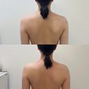 구미 인동 [ 젠에스테틱 ] / 등관리 잘하는 곳 – 승모근·라인관리까지 완벽했던 마사지관리샵