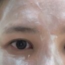 [서울/신사] 눈재수술 성형외과 발품 3곳 비교 상담 (비용/상담/AS 총정리)