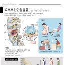 만성원광한의원 네이버블로그