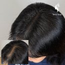 한올눈썹탈모커버 아카데미본점 | 일산 송포동 가르마 두피문신 – 자연스러운 헤어볼륨 회복 솔루션