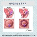 경부전기 이미지