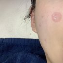 반송동169 | 반송동 피부관리 채움연구소 동탄본점 재방문