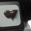 주식회사신세계의료기 | 헬스앤드림 초음파치료기 소노밴드 개봉기! -통증완화에 도움이 되요