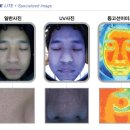 정피부 이미지