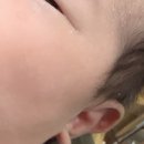 마벨산후조리원 퇴소, 해맑은소아청소년과의원 1차영유아검사, BCG접종 후기