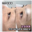 삼백번지 | 천안 속눈썹연장 눈의여왕 자연스러운 쌍용동 래쉬 후기