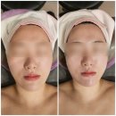 에스테틱마리에 | 의정부 피부관리 잘하는 곳 민락동 더마리에 에스테틱 솔직후기