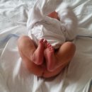 몽고반점 이미지