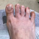 오니크네일 이미지