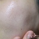 테라피 드 포레