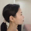 아테나 - 태안군 독샘로 18-1 | 군자역피부관리 추천 아테나뷰티 에스테틱 이중턱 고민 턱선 관리 후기