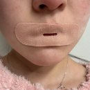 위드핏 | 입벌림방지 숙면보조 위드슬립 입벌림방지 테이프 립밴드 항균 에어핏