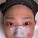 세븐일레븐 좌동지오점 | 장산피부관리 제이연에스테틱 여드름관리 후기