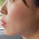 스타화이트치과의원 네이버블로그